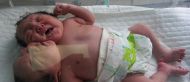 Bizarre: Child born with two heads in UP dies within hours of delivery, mother stable 