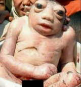 Frog faced baby becomes viral sensation on social media 