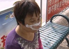 Man bites off wife's nose and eats it for not picking up his calls 