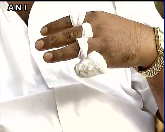 National Herald case: Man cuts off finger, offers it at Tirupati after Gandhi's given bail 