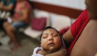 Zika breakout: Brazil confirms 91,387 cases so far; Rio de Janeiro tops list 