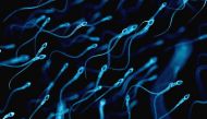 Artificial sperm can be made from men's own skin, says new Spanish research 