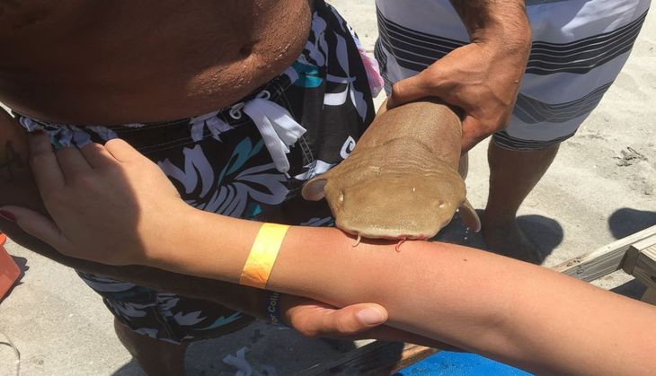 Young woman taken to hospital having nurse shark still attached to her arm