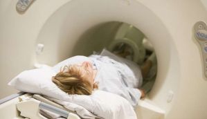 Do CT scans really cause cancer? 