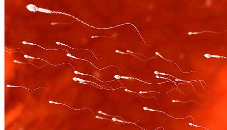 Sperm
