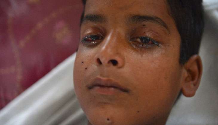 The pellet gun victims of Kashmir 2016 5