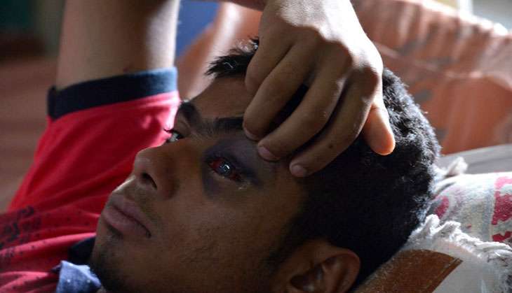 The pellet gun victims of Kashmir 2016 7