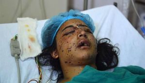 Kashmir unrest: What are pellets and why it's wrong to call them non-lethal 