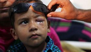 Pellets continue to blind Kashmiri kids. But it has stopped making news 