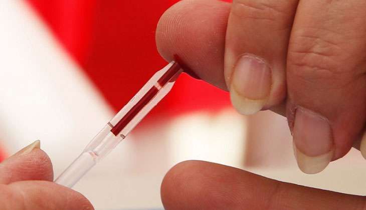 HIV self test