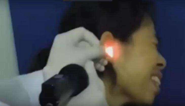 Doctor removes live cockroach from woman ear.jpg