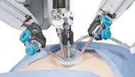 AIIMS introduces robotic arm for conducting neurosurgeries  