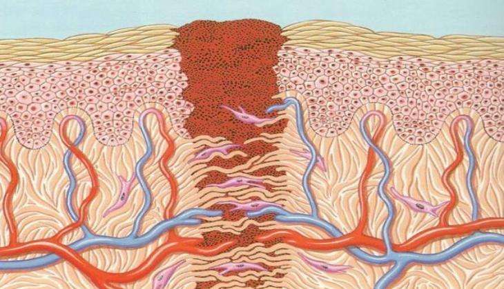 wound healing scar.jpg
