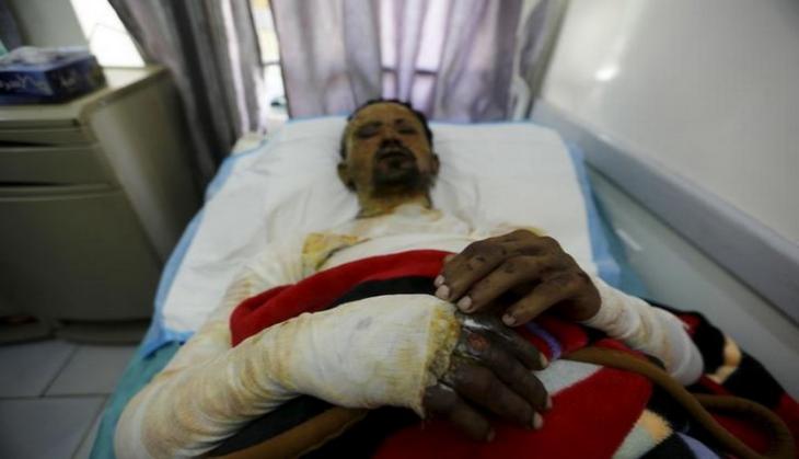 Massive explosion leaves 35 injured in Southern Iran