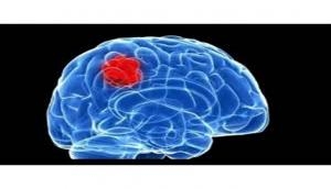 Brain cancer can now be detected five years earlier in blood: Study