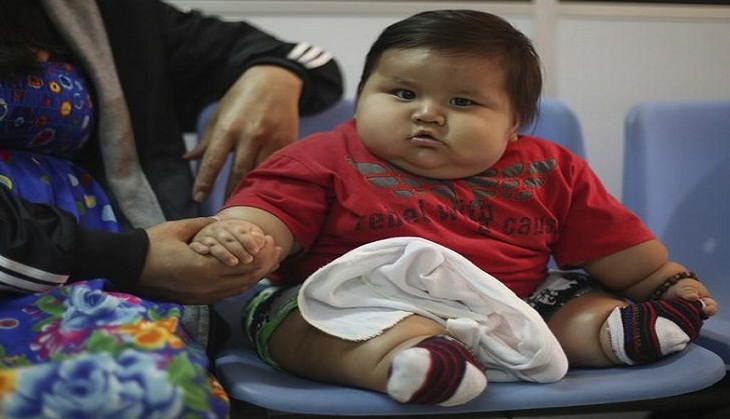 US tops the chart in worldwide obesity