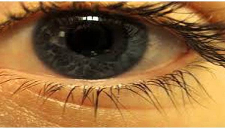 Time to get rid of dark under-eye circles!