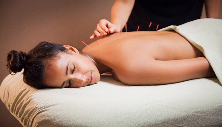 Acupuncture ineffective in treating PCOS-induced infertility: Study
