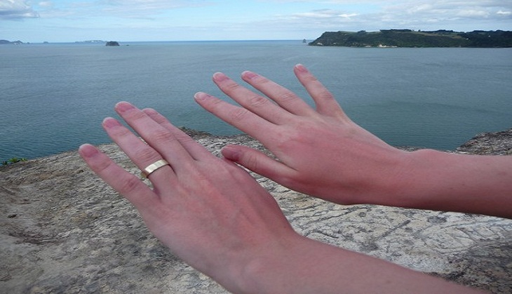 Vitamin D can help soothe sun-ravaged skin