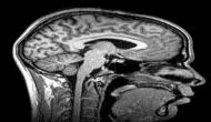 Study offers hope to neuro-tumor patients