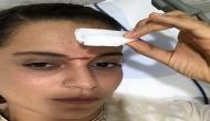 Kangana 'thrilled' to have battle scar on face!