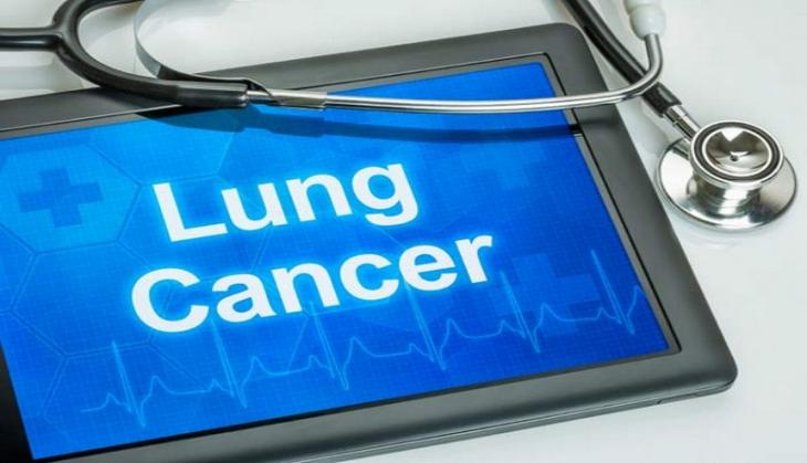 World Lung Cancer Day: Rise in number of cases in Delhi-NCR