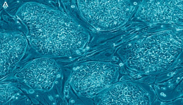 How to reprogram cells in our immune system