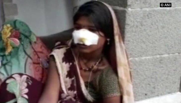 Woman nose slit off as she refuses to work as bonded labour