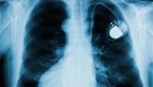 Three reasons why pacemakers are vulnerable to hacking