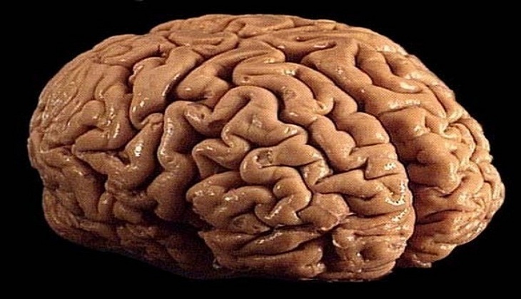 This cognition-enhancing drug may be most effective for Alzheimer's