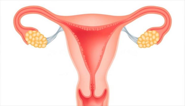 Most ovarian cancers start in fallopian tubes: Study
