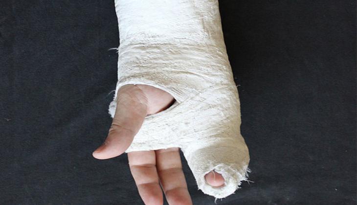  World Osteoporosis Day:  Many areas of world  at risk of bone health, says Study