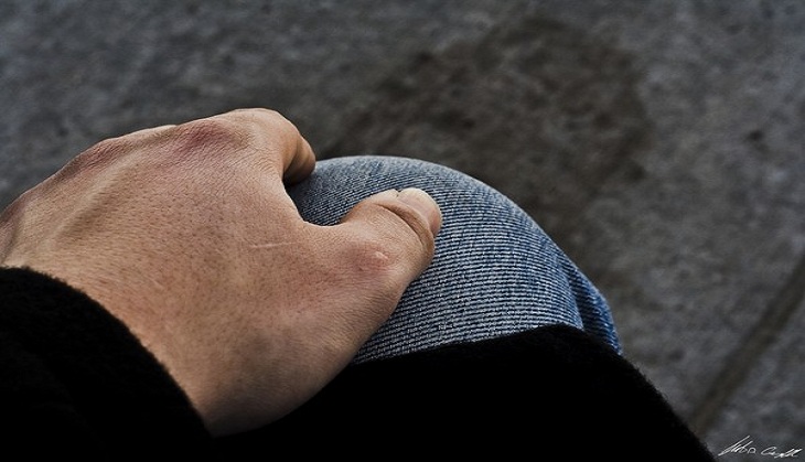 How obesity is changing risk, severity, cost of knee dislocations