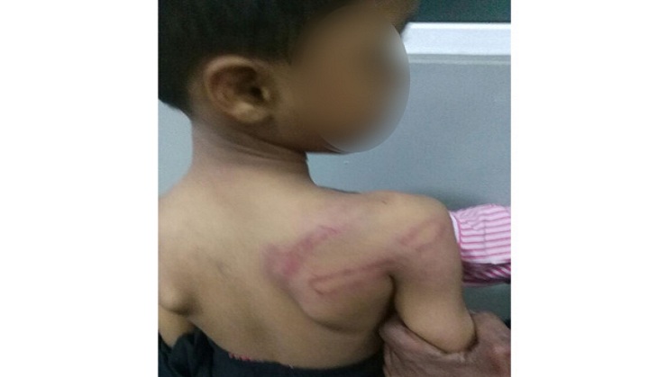 Hyderabad: Teacher arrested for caning 5-year-old
