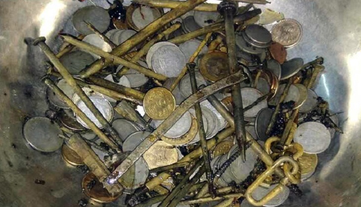 Madhya Pradesh: 263 coins, shaving Blades, needles found in man's stomach