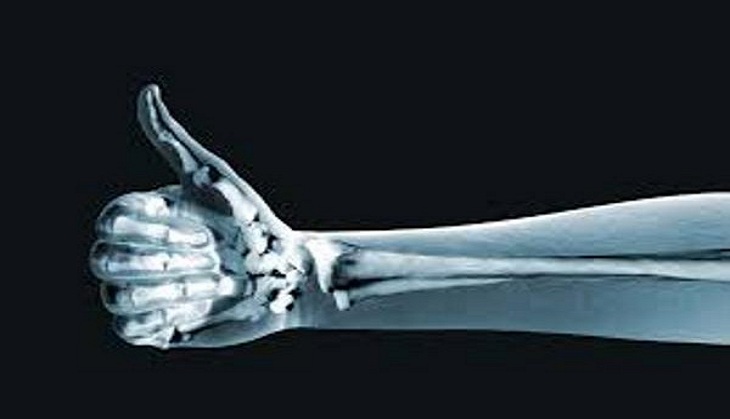 Steroid jabs for hip arthritis may risk bones