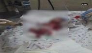 Delhi: Newborn, declared dead by hospital, found alive later