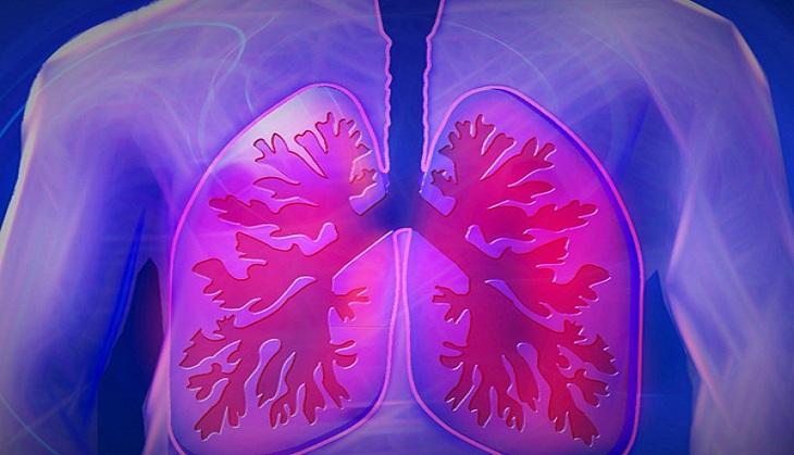 Busting myths about COPD