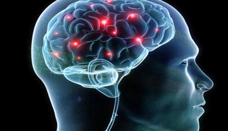 Brain stroke