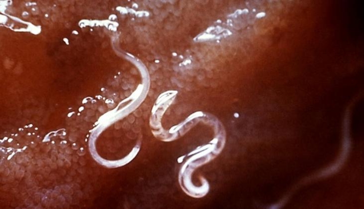 Gangaram doctor shocked, 22 liters blood