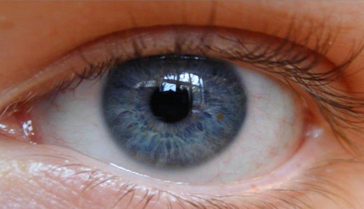 eye
