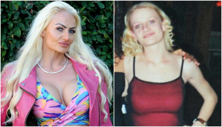 Love 'Barbie'? Meet Lady Kerry who spent Rs 9 lakh on surgeries just to look like her