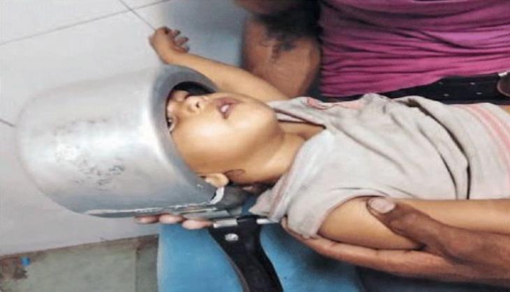 stuck child head in pressure cooker