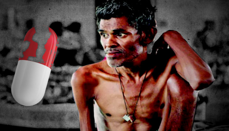 Indian scientists find asthma drug useful in TB as well