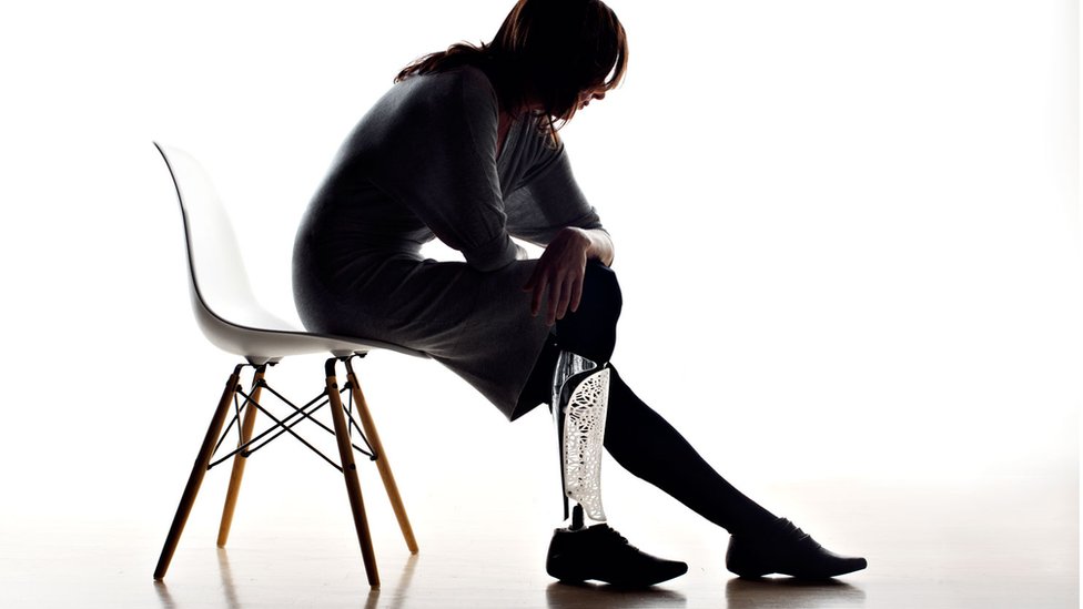 A new study reveals artificial limbs represented like real hands in brain