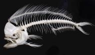 Ehhh! Chinese doctor removes 100 fish bones from man's rectum