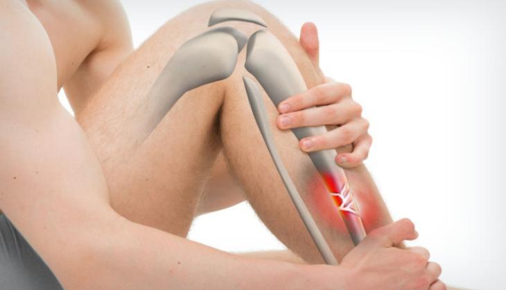 bones disease