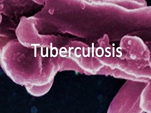 Genital TB can impact fertility in women