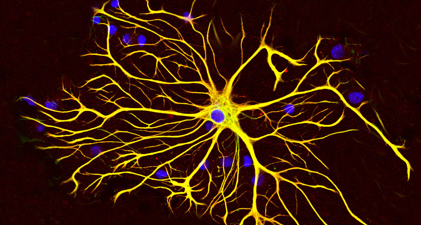 Shocking! Researchers find new brain cells in elderly humans