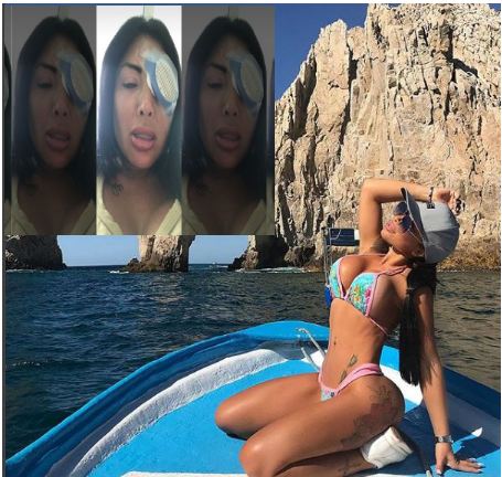 Insta sensation loses 80 percent vision after surgery to change her eye colour 